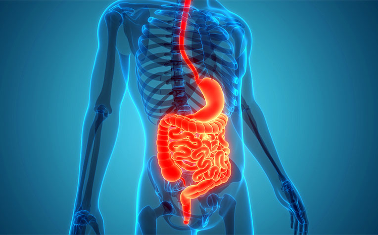 Chrohns Disease